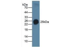 Detection of SP-C in Human Serum using Polyclonal Antibody to Surfactant Protein C (SP-C) (Surfactant Protein C antibody  (AA 24-197))