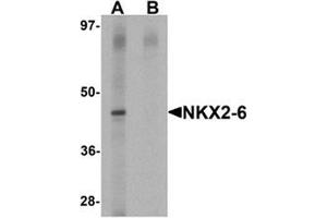 Western blot analysis of NKX2-6 in mouse spleen tissue lysate with NKX2-6 antibody at 1 ug/mL in (A) the absence and (B) the presence of blocking peptide. (NKX2-6 antibody  (Middle Region))