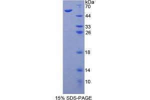 Image no. 1 for CD101 (CD101) (AA 302-531) protein (His tag,GST tag) (ABIN4988712)
