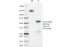 SDS-PAGE Analysis Purified p63 Mouse Monoclonal Antibody (TP63/11). (p63 antibody)