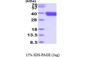 SDS-PAGE (SDS) image for Tumor-Associated Calcium Signal Transducer 2 (TACSTD2) (AA 31-274) protein (His tag) (ABIN5854731) (TACSTD2 Protein (AA 31-274) (His tag))