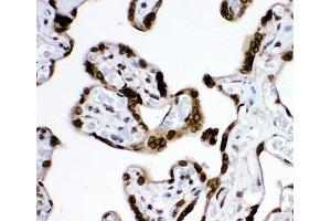 IHC-P: MAD1 antibody testing of human placenta tissue (PSMD14 antibody  (AA 362-632))