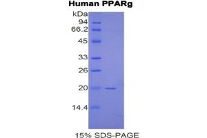 SDS-PAGE of Protein Standard from the Kit (Highly purified E. (PPARG ELISA Kit)