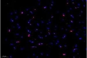 Immunofluorescent analysis of paraformaldehyde-fixed rat heart using,NCAPG2 (ABIN7074856) at dilution of 1: 1000 (NCAPG2 antibody)