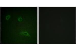 Immunofluorescence analysis of HeLa cells, using HER2 (Ab-1139) Antibody. (ErbB2/Her2 antibody  (AA 1111-1160))