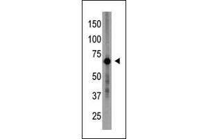 The anti-Cry1 N-term Pab (ABIN390079 and ABIN2840599) is used in Western blot to detect Cry1 in placenta tissue lysate.