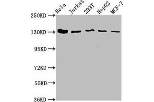 Western Blot Positive WB detected in: Hela whole cell lysate, Jurkat whole cell lysate, 293T whole cell lysate, HepG2 whole cell lysate, MCF-7 whole cell lysate All lanes: CAND1 antibody at 4. (CAND1 antibody  (AA 1150-1230))