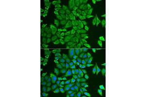 Immunofluorescence analysis of HeLa cells using APEH antibody. (APEH antibody  (AA 1-260))