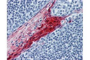 Anti-SPRR3 antibody IHC of human tonsil. (SPRR3 antibody  (AA 1-162))