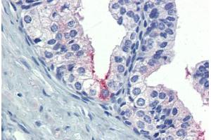 Prostate: Formalin-Fixed, Paraffin-Embedded (FFPE) (AMH antibody  (AA 468-517))