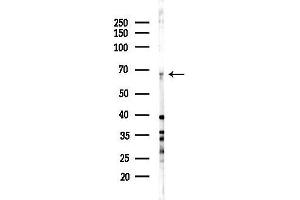 anti-Butyrylcholinesterase (BCHE) (C-Term) antibody