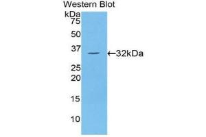 Western Blotting (WB) image for anti-Protein Kinase C, eta (PRKCH) (AA 355-614) antibody (ABIN1860237) (PKC eta antibody  (AA 355-614))