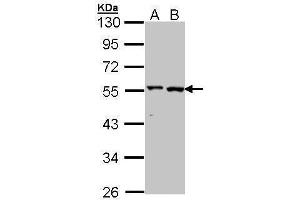 WB Image Sample (30 ug of whole cell lysate) A: A431 , B: Hela 10% SDS PAGE antibody diluted at 1:1000 (ALT antibody  (N-Term))