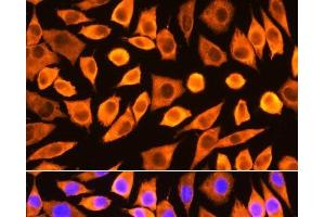 Immunofluorescence (IF) image for anti-Ribosomal Protein S3 (RPS3) antibody (ABIN7257140)