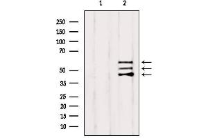 Western Blotting (WB) image for anti-SHC (Src Homology 2 Domain Containing) Transforming Protein 1 (SHC1) antibody (ABIN6265062)
