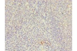 Immunohistochemistry of paraffin-embedded human tonsil tissue using ABIN7145623 at dilution of 1:100 (NUDT2 antibody  (AA 1-147))