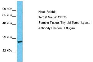 Host: Rabbit Target Name: ORC6 Sample Type: Thyroid Tumor lysates Antibody Dilution: 1. (ORC6 antibody  (N-Term))