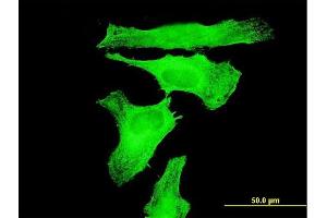 Immunofluorescence of monoclonal antibody to TAOK3 on HeLa cell. (TAO Kinase 3 antibody  (AA 809-898))
