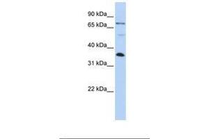 Image no. 1 for anti-LIM and SH3 Protein 1 (LASP1) (AA 182-231) antibody (ABIN6738999) (LASP1 antibody  (AA 182-231))