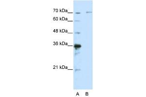 WB Suggested Anti-IRAK3 Antibody Titration:  0. (IRAK3 antibody  (C-Term))