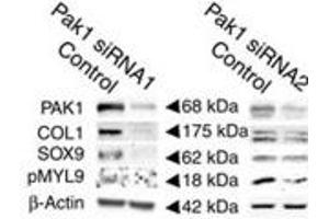 Decreases in the levels of activated HSC markers, SOX9, COL1 and phosphoMyl9 (PMYL9) following PAK-1 abrogation by siRNA1 in activated rat HSCs relative to their respective scrambled control levels.