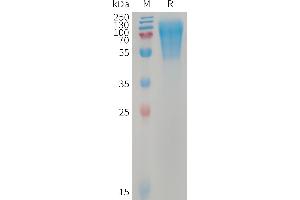 LY6/PLAUR Domain Containing 3 (LYPD3) (AA 31-325) protein (His tag)