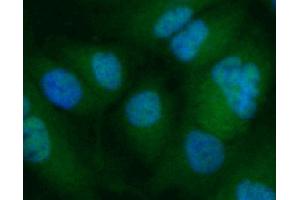 Cells exposed to anisomycin for 30 minutes (MAPK14 antibody  (pThr180))