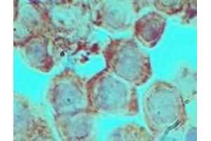 Image no. 2 for anti-Distal-Less Homeobox 3 (DLX3) (AA 220-270) antibody (ABIN960137) (DLX3 antibody  (AA 220-270))