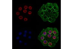 ABIN6262331 and ABIN6277975 staining HepG2 cells by IF/ICC.