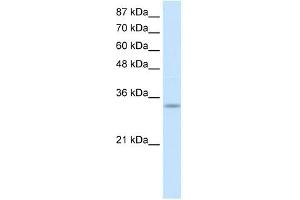 PRKRA antibody used at 1 ug/ml to detect target protein. (PRKRA antibody  (Middle Region))