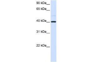 WB Suggested Anti-GOT2 Antibody   Titration: 1 ug/ml   Positive Control: 293T Whole Cell (GOT2 antibody  (N-Term))