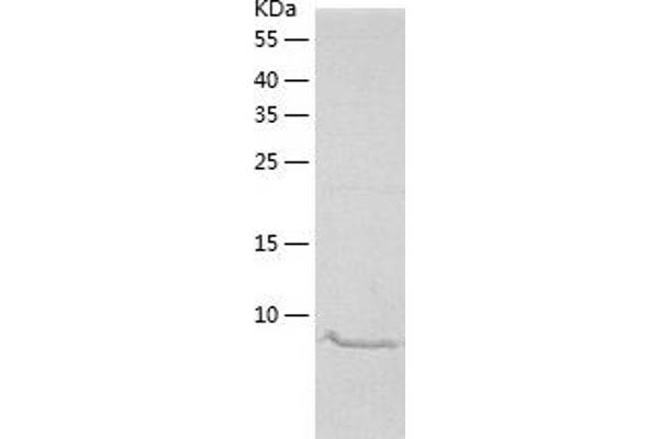 MGP Protein (AA 20-96) (His tag)