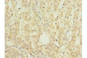 Immunohistochemistry of paraffin-embedded human adrenal gland tissue using ABIN7151150 at dilution of 1:100 (RNF138 antibody  (AA 2-245))