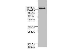 Western blot All lanes: CR1 antibody at 3. (CD35 antibody  (AA 420-550))
