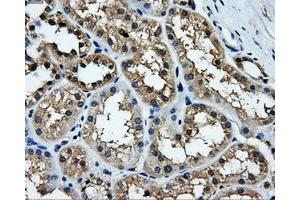 Immunohistochemical staining of paraffin-embedded liver tissue using anti-TTLL12mouse monoclonal antibody. (TTLL12 antibody)