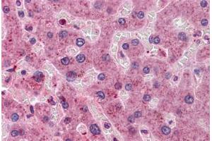 Human Liver: Formalin-Fixed, Paraffin-Embedded (FFPE) (HYI antibody  (AA 1-218))