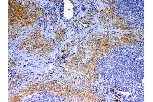 IHC analysis of CD40L using anti-CD40L antibody . (CD40 Ligand antibody  (AA 107-260))