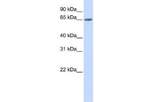 WB Suggested Anti-YTHDF3 Antibody Titration: 0. (YTHDF3 antibody  (N-Term))