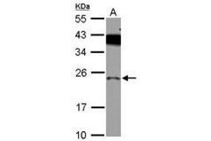 Image no. 2 for anti-PRELI Domain Containing 1 (PRELID1) (AA 1-189) antibody (ABIN1500400)