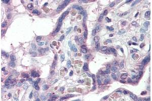 Human Placenta (formalin-fixed, paraffin-embedded) stained with SLC12A4 antibody ABIN337105 at 5 ug/ml followed by biotinylated anti-goat IgG secondary antibody ABIN481715, alkaline phosphatase-streptavidin and chromogen. (SLC12A4 antibody  (AA 997-1007))