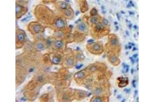 Used in DAB staining on fromalin fixed paraffin-embedded Liver tissue (Emilin1 antibody  (AA 803-1016))