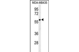 NARFL anticorps  (AA 240-269)