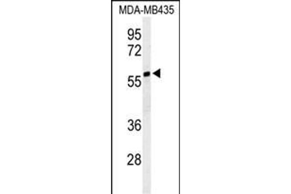 NARFL Antikörper  (AA 240-269)