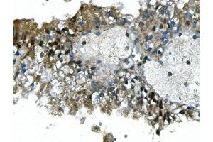 IHC analysis of UBR2 using anti-UBR2 antibody (ABIN7599609). (UBR2 antibody  (AA 10-664))