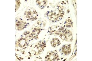 Immunohistochemistry of paraffin-embedded human breast using PRPF3 Antibody.