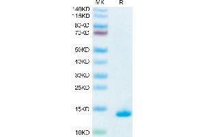 Human Mature TGF beta 1 on Tris-Bis PAGE under reduced condition. (TGFB1 Protein)