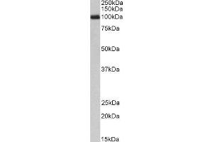 ABIN4902636 (1µg/ml) staining of Peripheral Blood Lymphocytes lysate (35µg protein in RIPA buffer). (CSF3R antibody)