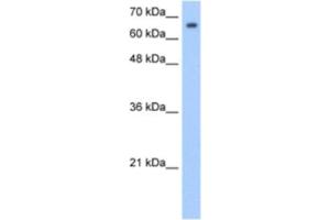 Western Blotting (WB) image for anti-Synovial Apoptosis Inhibitor 1, Synoviolin (SYVN1) antibody (ABIN2462686) (SYVN1 antibody)