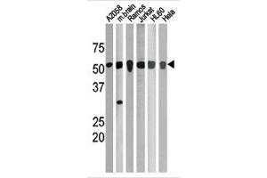 Image no. 1 for anti-Checkpoint Kinase 1 (CHEK1) (pSer280) antibody (ABIN358108) (CHEK1 antibody  (pSer280))