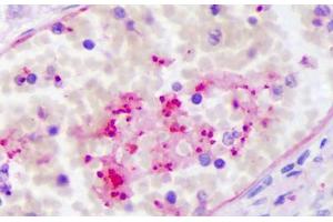 Anti-PPBP antibody IHC staining of human intravascular platelets. (CXCL7 antibody)